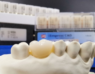 SỨ ĐA LỚP MULTI 3D