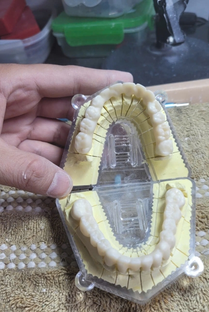 Chọn Trung Tâm Cắt Sườn Zirconia: 8 Câu Labo Nên Hỏi Trước Khi Gửi Ca