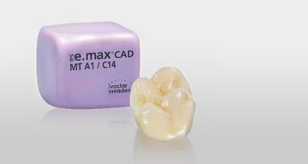 Phục hình Inlay/Onlay sứ e.max CAD tại KTSmile
