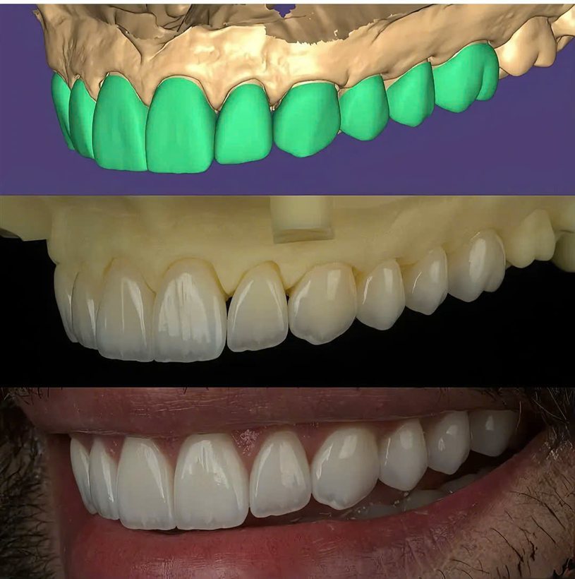 Từ thiết kế đến phục hình thực tế