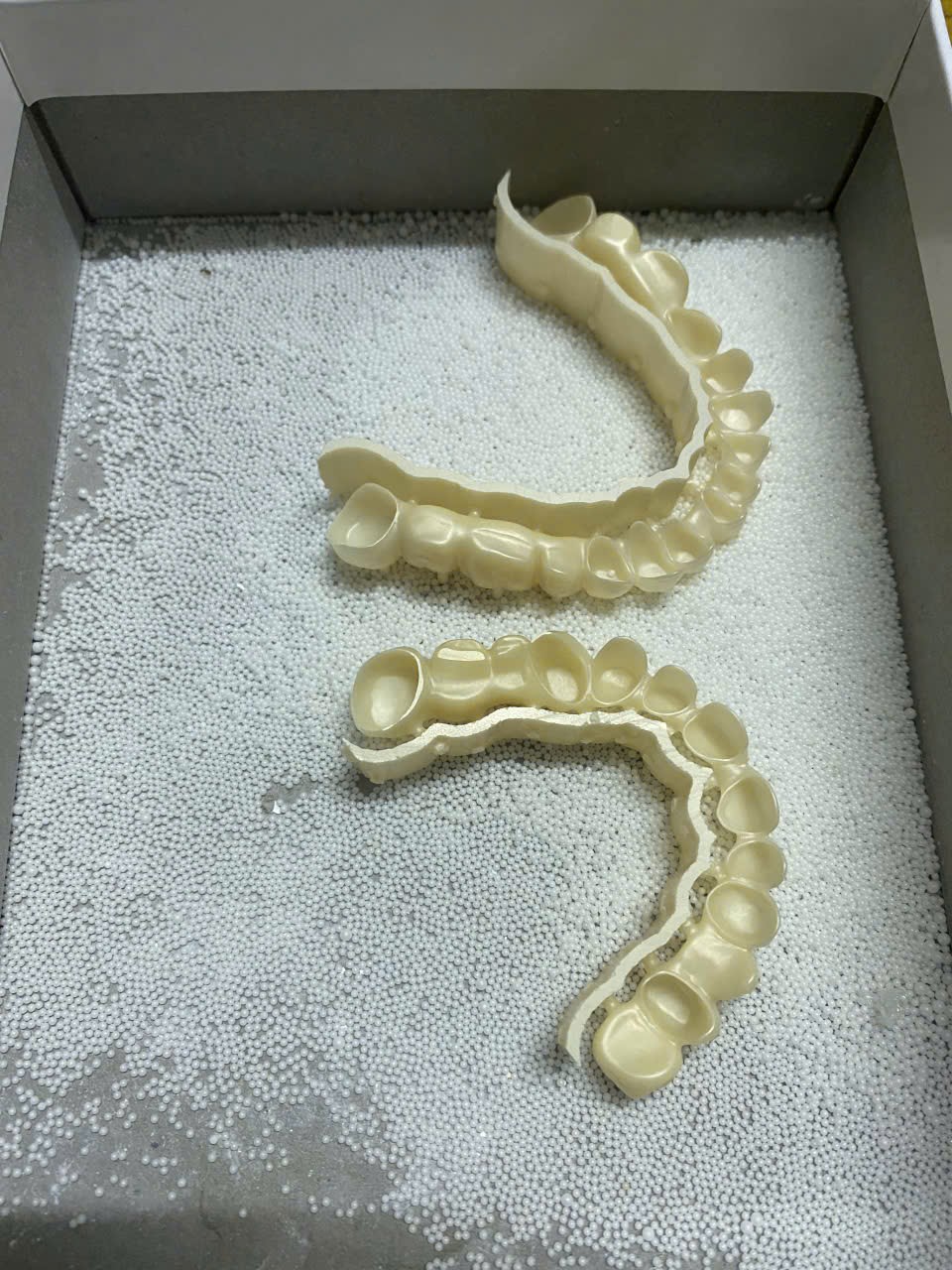 Sườn cầu Zirconia toàn hàm sau thiêu kết, nhiều vùng nối liên tiếp
