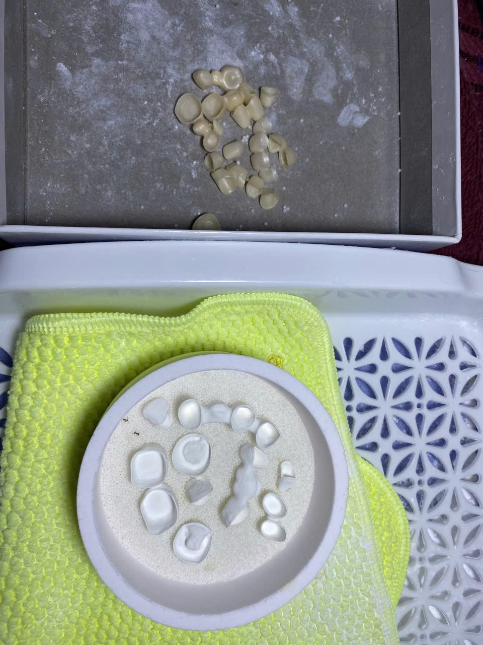Sườn Zirconia trước và sau thiêu kết